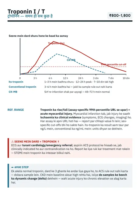Troponin I / T — timing — sample page from Lab Report Decoded Vol 1